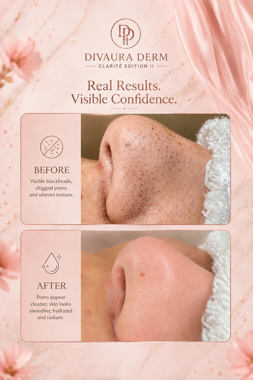 Divaura Derm Clarité Edition II